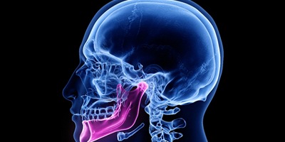 X-ray of jaw
