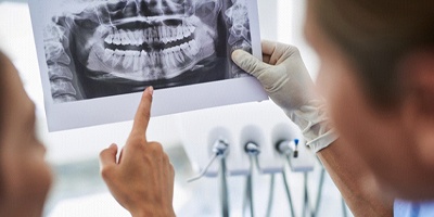 dental consultation