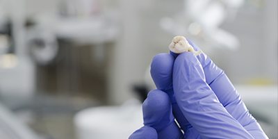 Gloved hand holding extracted tooth