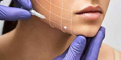 Graphic depicting facial plastic surgery
