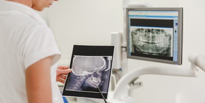 Oral surgeon checking X-rays for signs of trauma