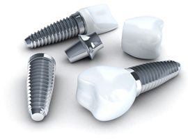 Dental implants, abutments, and restorations on white backdrop