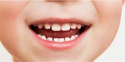 Closeup of child's smile