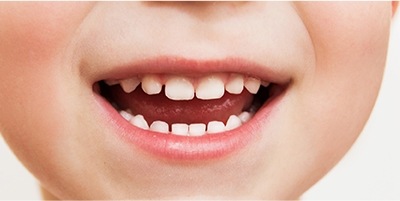 Closeup of child's smile