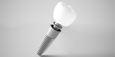 Dental implant post, abutment, and crown against gray background