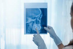 Doctor pointing at patient’s jaw on X-ray