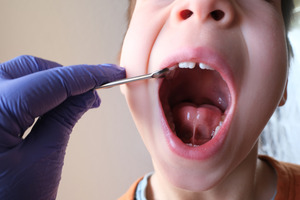 Child opening mouth to show tongue-tie